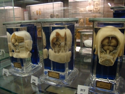Audioguide d'Amsterdam : explorez le musée Vrolik